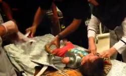 چرخگوشت مچ دست کودک اصفهانی را قطع کرد چرخگوشت مچ دست کودک اصفهانی را قطع کرد